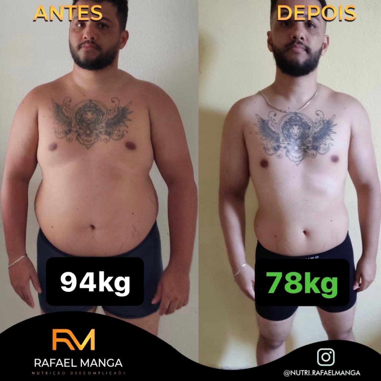 Comparação de antes e depois de um paciente do Rafael Manga, evolução masculina 3