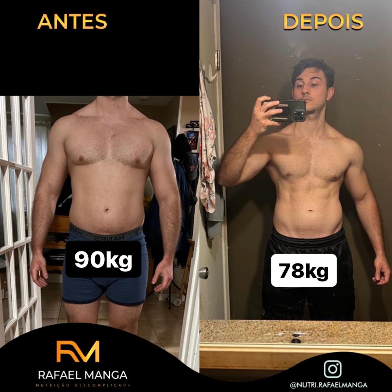 Comparação de antes e depois de um paciente do Rafael Manga, evolução masculina 4