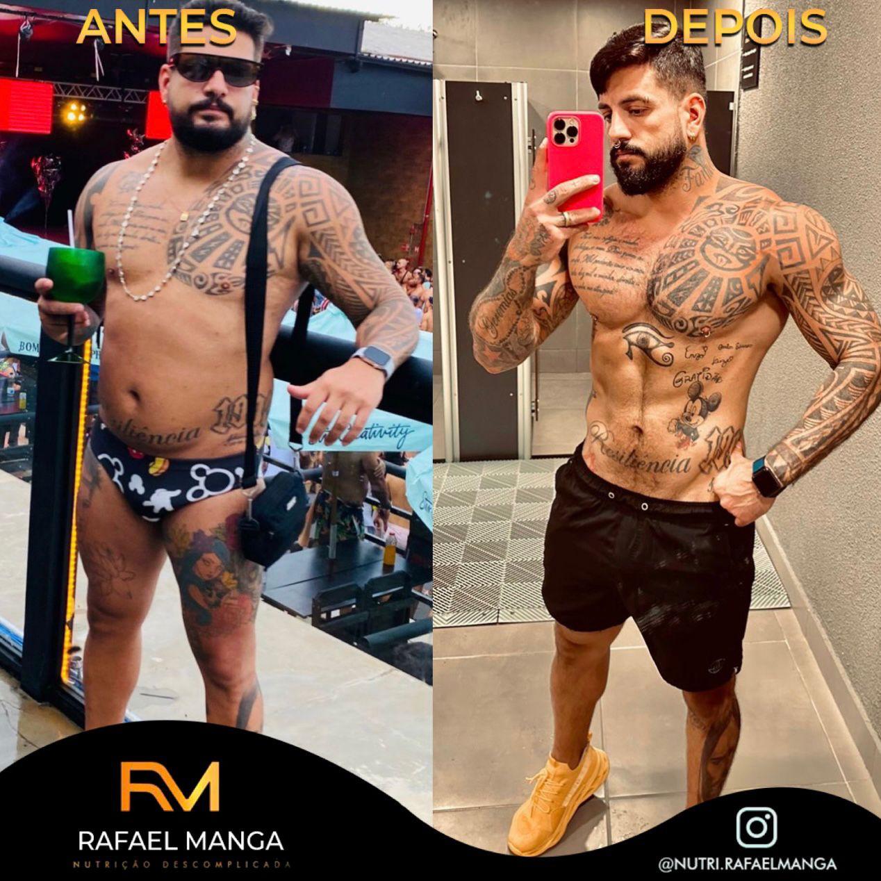 Comparação de antes e depois de um paciente do Rafael Manga, evolução masculina 5