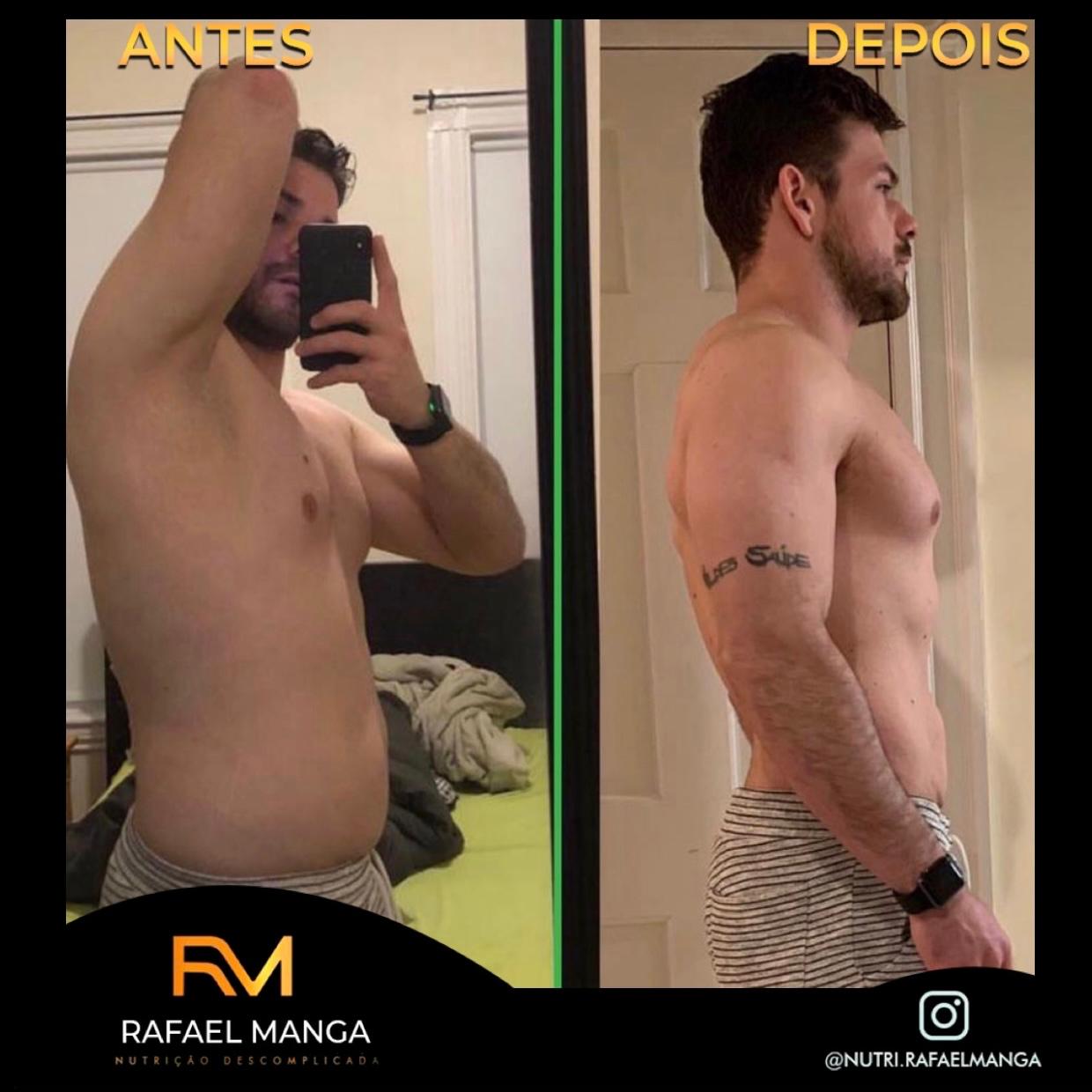 Comparação de antes e depois de um paciente do Rafael Manga, evolução masculina 6