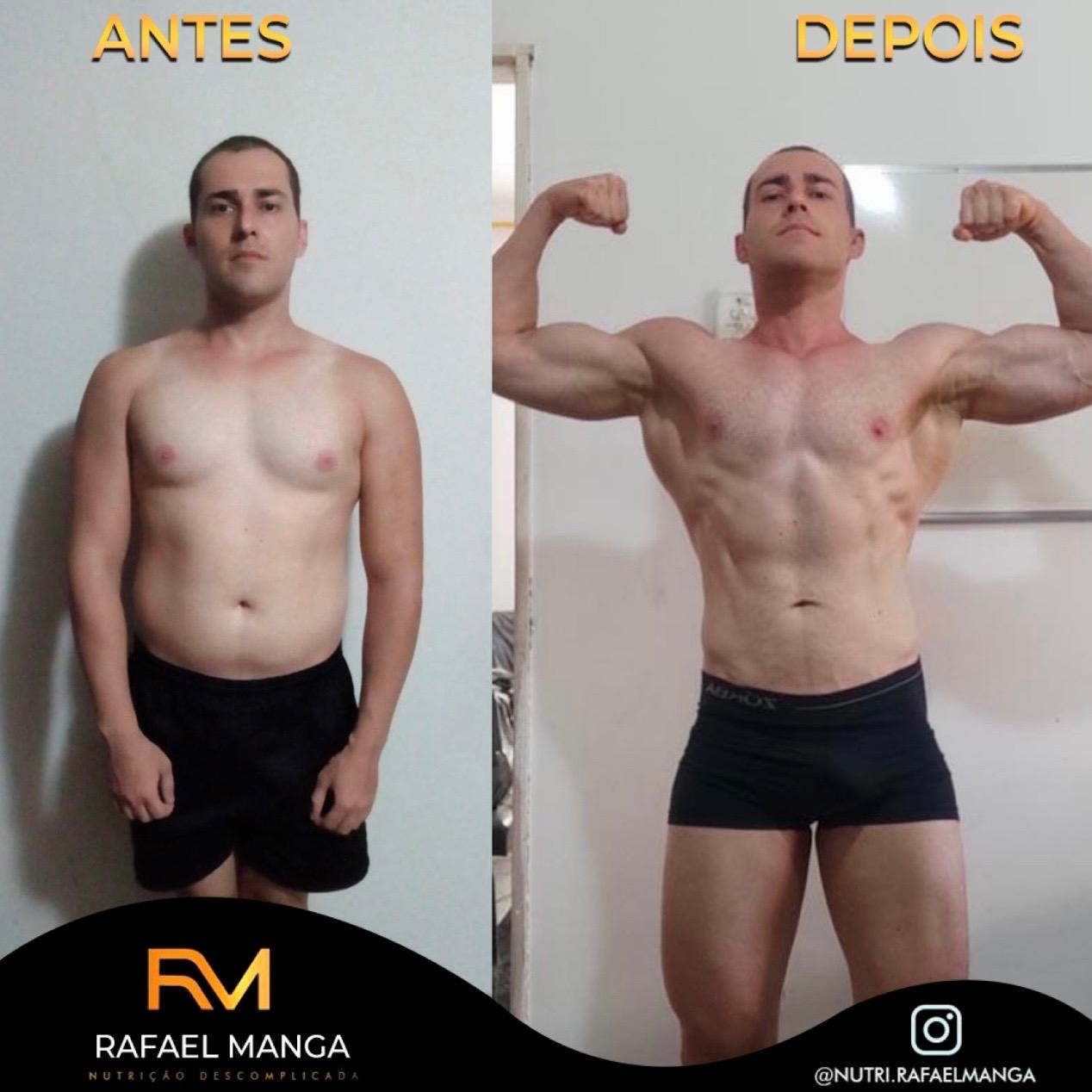 Comparação de antes e depois de um paciente do Rafael Manga, evolução masculina 7