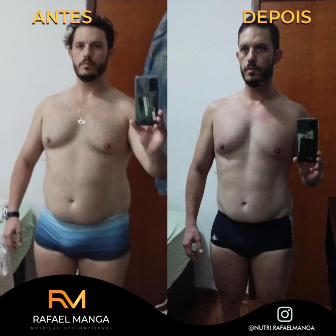 Comparação de antes e depois de um paciente do Rafael Manga, evolução masculina 8