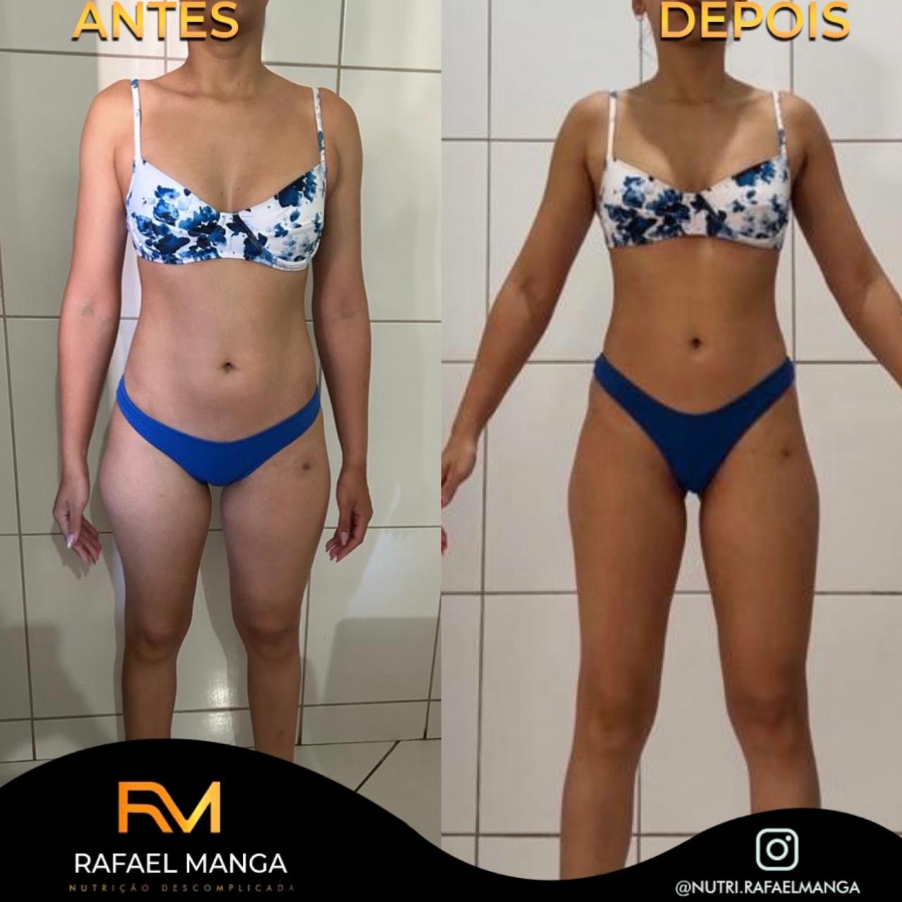 Comparação de antes e depois de uma paciente usando biquíni azul estampado