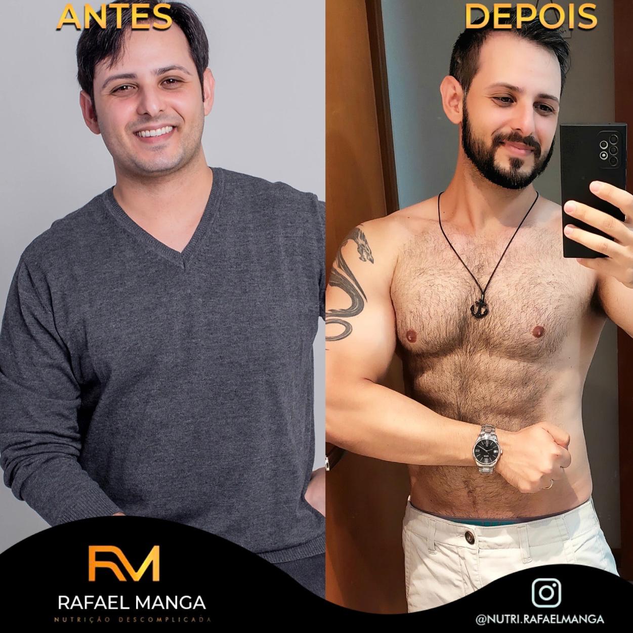 Comparação de antes e depois de um paciente do Rafael Manga, evolução masculina 2
